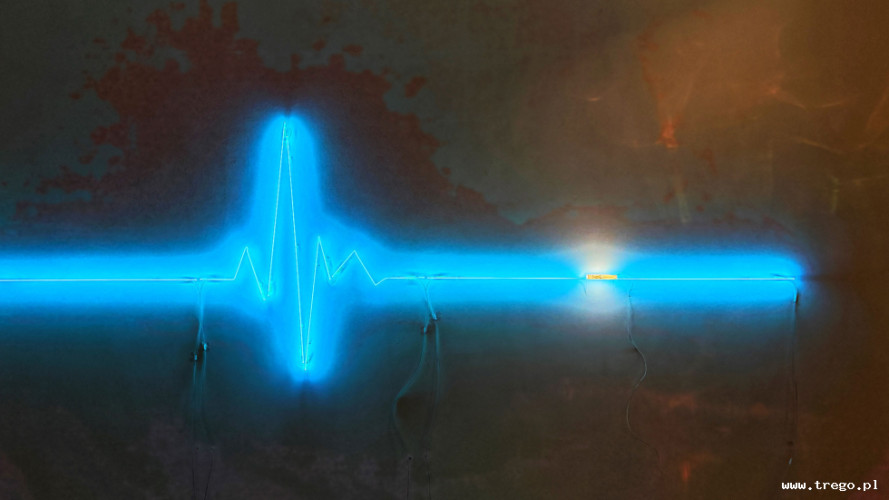 Zdjęcie z galerii posta: Galeria Miejska w Sopocie – miejsce spotkań ze sztuką współczesną - Kultura